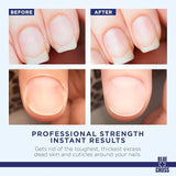 Cuticle Remover Cream - 2oz